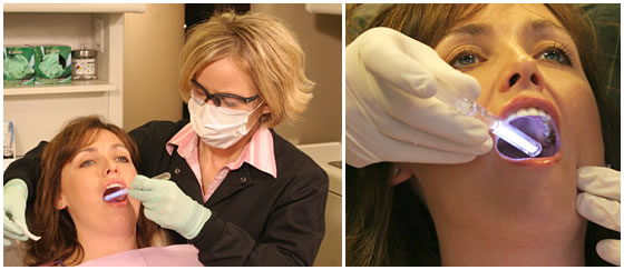 ViziLite Plus - Dental hygienist in Mississauga, Meadowvale, Streetsville, Milton, Georgetown, Brampton